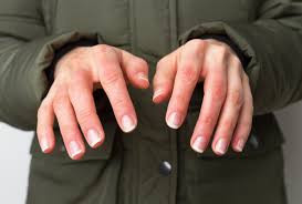 Luka Akibat Trauma Dingin