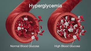 Hiperglikemia