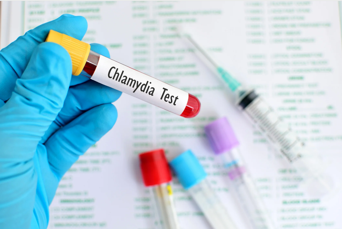 Chlamydia IgM