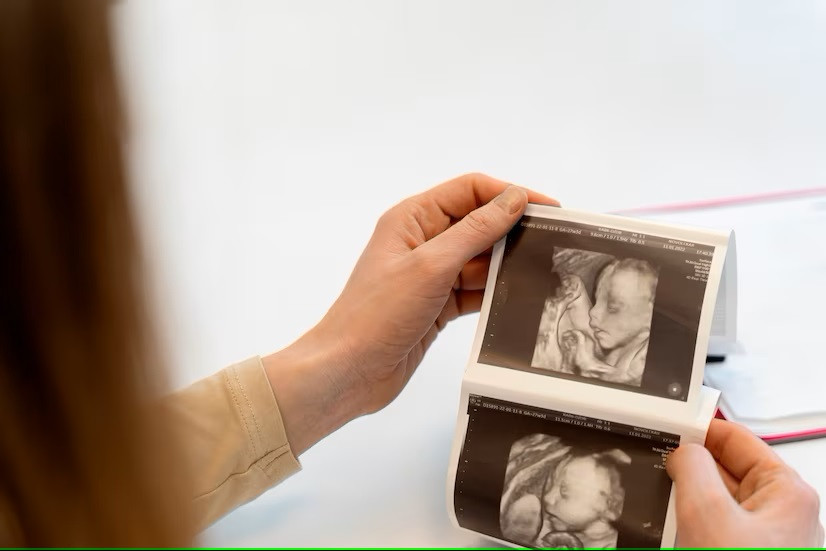 Manfaat dan Cara Menghitung Pergerakan Janin