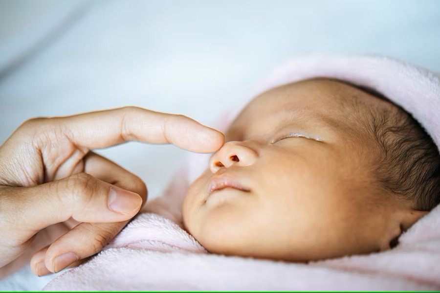 Kernikterus, Penyakit Kuning Parah yang Bisa Merusak Otak Bayi Baru Lahir